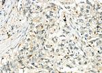 CTLA-4 Polyclonal Antibody