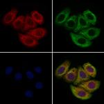 CUBN Polyclonal Antibody