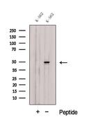 CUG-BP2 Polyclonal Antibody