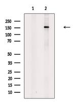 CUX1 Polyclonal Antibody
