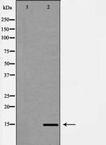 Cytochrome B5 Polyclonal Antibody