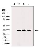 CYB5R1 Antibody in Western Blot (WB)