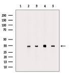CYB5R1 Polyclonal Antibody