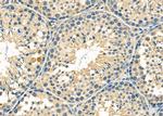 CYB5R2 Antibody in Immunohistochemistry (Paraffin) (IHC (P))