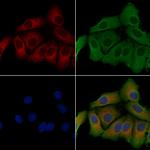 CYB5R3 Polyclonal Antibody