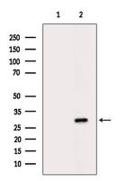 CYB5R3 Antibody in Western Blot (WB)