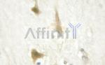 Cyclin D1 Polyclonal Antibody