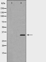 Cyclin D2 Polyclonal Antibody