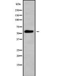 CYP26A1 Polyclonal Antibody