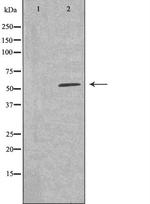CYP26A1 Polyclonal Antibody