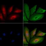 MTCO1 Polyclonal Antibody