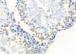 MTCO1 Antibody in Immunohistochemistry (Paraffin) (IHC (P))