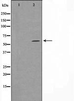 CYP24A1 Polyclonal Antibody