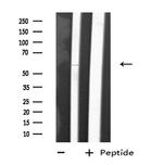 CYP2D6 Antibody in Western Blot (WB)