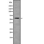 Cytokeratin 6A Antibody in Western Blot (WB)