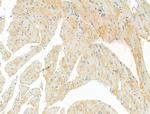 DYNC1I1 Antibody in Immunohistochemistry (Paraffin) (IHC (P))