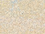 DYNC1I1 Antibody in Immunohistochemistry (Paraffin) (IHC (P))