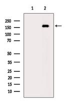 DAPK1 Polyclonal Antibody