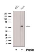 HIP55 Antibody in Western Blot (WB)