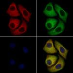 DCC Polyclonal Antibody