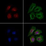 DCP2 Polyclonal Antibody