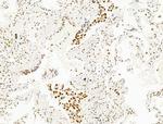 DCP2 Antibody in Immunohistochemistry (Paraffin) (IHC (P))