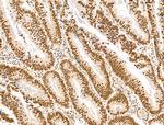 DCP2 Antibody in Immunohistochemistry (Paraffin) (IHC (P))