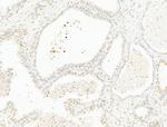 DCP2 Antibody in Immunohistochemistry (Paraffin) (IHC (P))