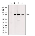 DCP2 Antibody in Western Blot (WB)