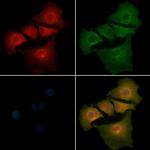 MCK10 Polyclonal Antibody