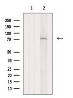 DDX18 Antibody in Western Blot (WB)
