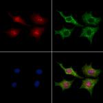 DDX55 Polyclonal Antibody