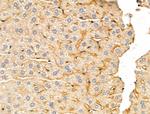 DERL2 Antibody in Immunohistochemistry (Paraffin) (IHC (P))