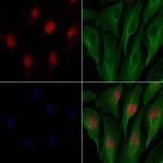 DFFB Antibody in Immunocytochemistry (ICC/IF)