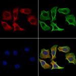 DHH Polyclonal Antibody