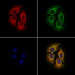 DHRS4 Polyclonal Antibody