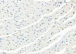 DHX9 Antibody in Immunohistochemistry (Paraffin) (IHC (P))