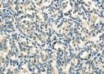 DHX9 Antibody in Immunohistochemistry (Paraffin) (IHC (P))