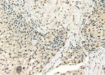 DHX9 Antibody in Immunohistochemistry (Paraffin) (IHC (P))