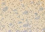 DHX9 Antibody in Immunohistochemistry (Paraffin) (IHC (P))