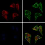 DIABLO Polyclonal Antibody