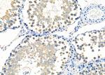 DIABLO Antibody in Immunohistochemistry (Paraffin) (IHC (P))