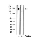 DIAPH1 Antibody in Western Blot (WB)