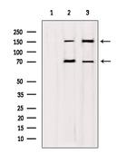 DIAPH1 Polyclonal Antibody