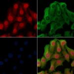 RNA pol II CTD Antibody in Immunocytochemistry (ICC/IF)
