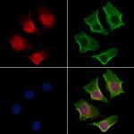 POLQ Polyclonal Antibody