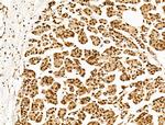 POLQ Antibody in Immunohistochemistry (Paraffin) (IHC (P))
