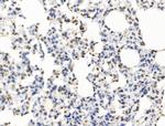 POLQ Antibody in Immunohistochemistry (Paraffin) (IHC (P))