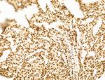 POLQ Antibody in Immunohistochemistry (Paraffin) (IHC (P))