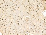 POLQ Antibody in Immunohistochemistry (Paraffin) (IHC (P))